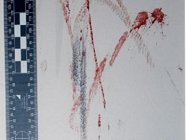 Blood smears on the children’s wall. Blood smears on the children’s wall.