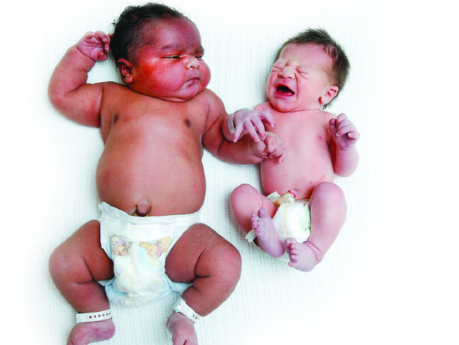 Baby Brian is double the size of an average baby.
Baby Brian is double the size of an average baby.