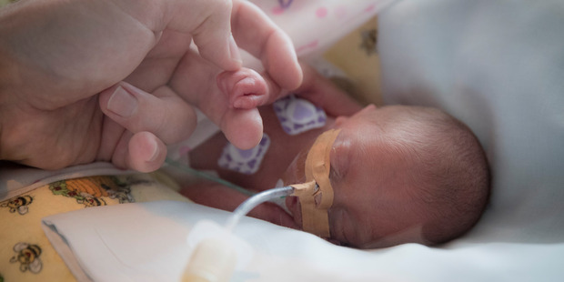 Jason Agnew holds the hand of Olivia Agnew, his 25-week-old premature baby. Photo / Greg Bowker
Jason Agnew holds the hand of Olivia Agnew, his 25-week-old premature baby. Photo / Greg Bowker